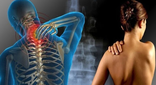 Fibromialgia, el dolor silencioso que afecta la calidad de vida de las mujeres